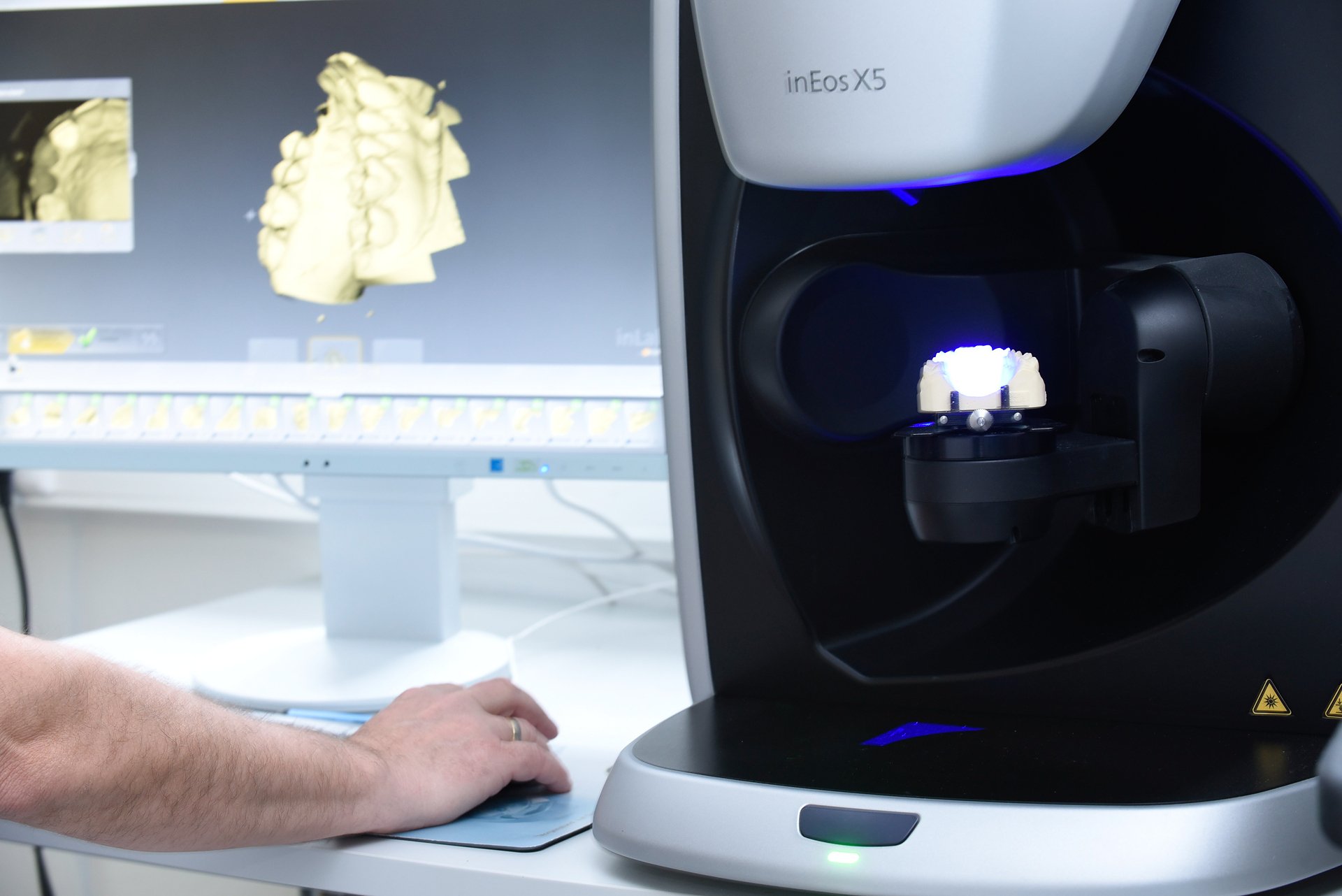 Laborscanner inEos X5 mit der Konstruktion am Bildschirm